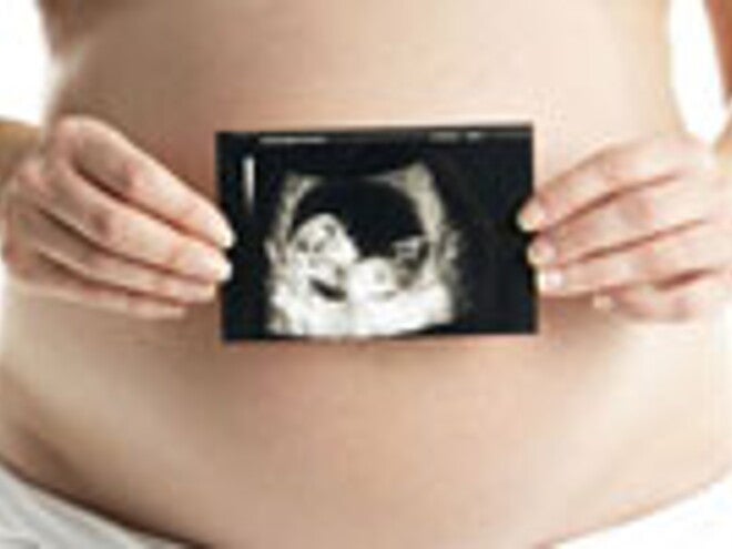 ¿Cuál es la utilidad de la placenta? ¿Cuál es la utilidad de la placenta?