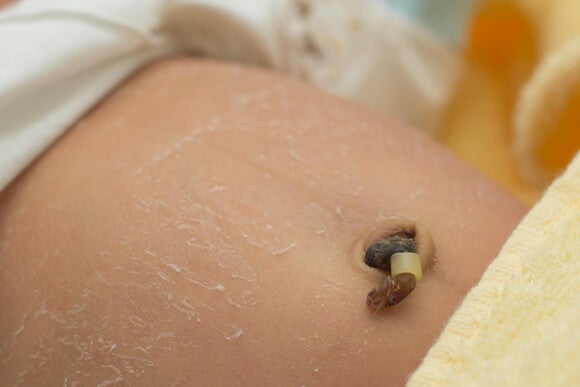 Cuidados del Bebé Recién Nacido: Guía Completa Pancita de bebé recién nacido con el cordón umbilical